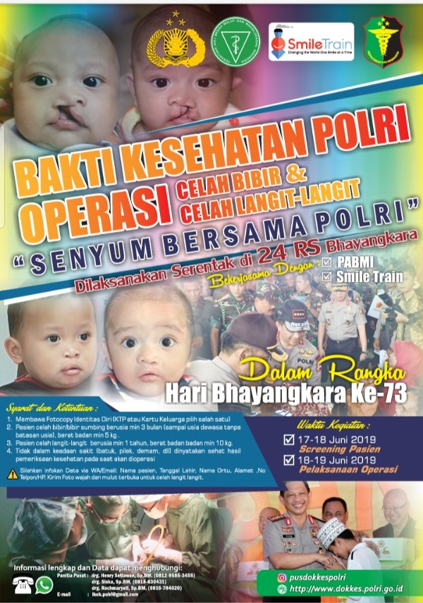 RS Sartika Asih Bandung Gelar Layanan Operasi Celah Bibir Dan Celah Langit-langit, Gratis!